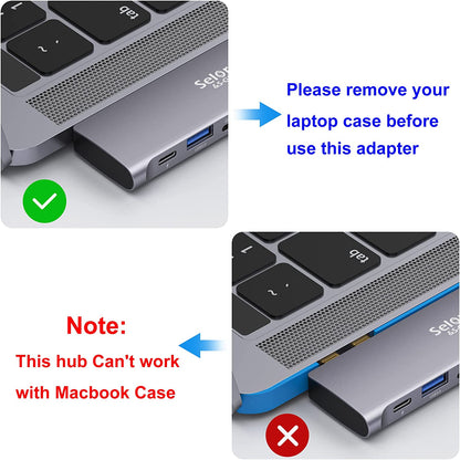 USB C Adapter for Macbook Pro/Air M1 M2 M3 2021 2020 2019 13" 15" 16", 6 in 1 USB-C Hub Macbook Pro Accessories with 3 USB 3.0 Ports,Usb C to SD/TF Card Reader and 100W Thunderbolt 3 PD Port